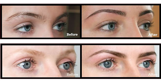 Eyebrows